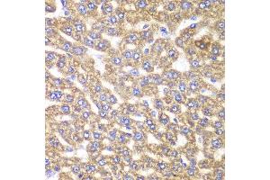 Immunohistochemistry of paraffin-embedded rat liver using UGDH antibody at dilution of 1:100 (400x lens). (UGDH 抗体)