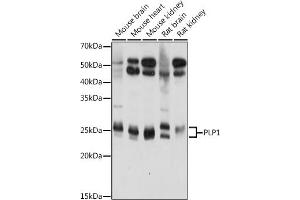 Western blot analysis of extracts of various cell lines, using PLP1 antibody (ABIN7269724) at 1:1000 dilution. (PLP1 抗体  (AA 145-210))