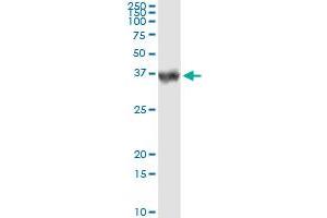 Western Blotting (WB) image for anti-Carbonic Anhydrase I (CA1) (AA 1-261) antibody (ABIN560129)