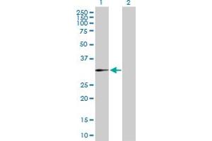 Western Blot analysis of DHRS3 expression in transfected 293T cell line by DHRS3 MaxPab polyclonal antibody. (DHRS3 抗体  (AA 1-302))