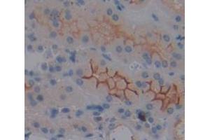 IHC-P analysis of Kidney tissue, with DAB staining. (MT-ND1 抗体  (AA 19-84))