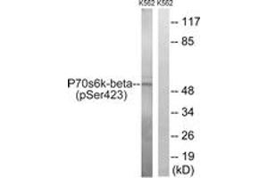 Western blot analysis of extracts from K562 cells treated with EGF 200ng/ml 5', using p70 S6 Kinase beta (Phospho-Ser423) Antibody. (RPS6KB2 抗体  (pSer423))