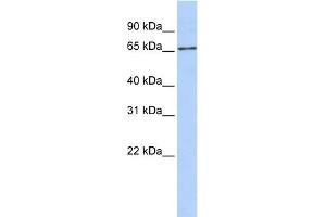 WB Suggested Anti-SLC27A6 Antibody Titration:  0. (SLC27A6 抗体  (Middle Region))