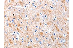 The image on the left is immunohistochemistry of paraffin-embedded Human brain tissue using ABIN7191217(KISS1 Antibody) at dilution 1/5, on the right is treated with synthetic peptide. (KISS1 抗体)