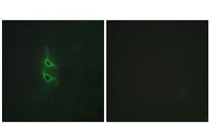 Immunofluorescence (IF) image for anti-Mannose Receptor, C Type 2 (MRC2) (N-Term) antibody (ABIN1850036) (MRC2 抗体  (N-Term))