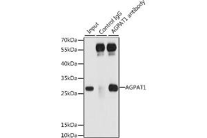Immunoprecipitation analysis of 200 μg extracts of 293T cells, using 3 μg  antibody (ABIN6132132, ABIN6136638, ABIN6136639 and ABIN6222173). (AGPAT1 抗体  (AA 204-283))