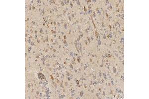 IHC analysis of Mitochondrial Dicarboxylate Carrier/SLC25A10 using anti-Mitochondrial Dicarboxylate Carrier/SLC25A10 antibody (ABIN7601497).