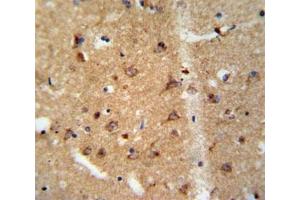 Immunohistochemistry (IHC) image for anti-Glial Cell Line Derived Neurotrophic Factor (GDNF) (AA 8-36) antibody (ABIN3031042)