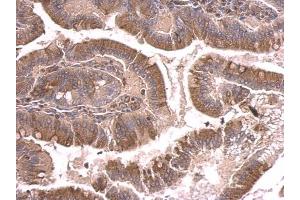 IHC-P Image beta Tubulin 2 antibody detects beta Tubulin 2 protein at cytosol on mouse duodenum by immunohistochemical analysis.