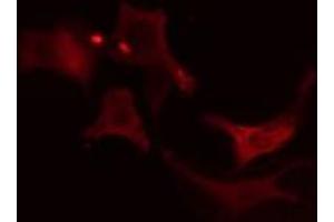 Immunofluorescence (fixed cells) (IF/ICC) image for anti-Solute Carrier Family 9 (Sodium/hydrogen Exchanger), Member 6 (SLC9A6) (C-Term) antibody (ABIN6258569)
