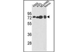 Western blot analysis of HADHA Antibody (C-term) in A2058, A375, NCI-H460, Ramos cell line lysates (35ug/lane). (HADHA 抗体  (C-Term))