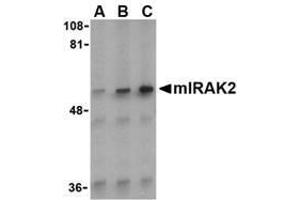 Western blot analysis of IRAK2 in A-20 whole cell lysate with AP30440PU-N IRAK2 antibody (C2) at (A) 0. (IRAK2 抗体  (C-Term))