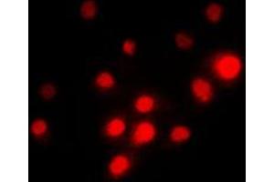 Immunofluorescent analysis of TFE3 staining in PC12 cells. (TFE3 抗体  (Center))