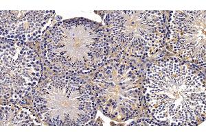 Immunohistochemistry (IHC) image for anti-Insulin-Degrading Enzyme (IDE) (AA 753-973) antibody (ABIN7434305)