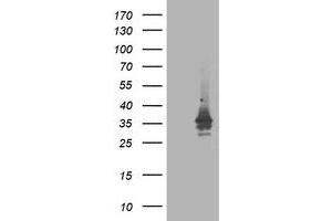 HEK293T cells were transfected with the pCMV6-ENTRY control (Left lane) or pCMV6-ENTRY ATG3 (Right lane) cDNA for 48 hrs and lysed. (ATG3 抗体)