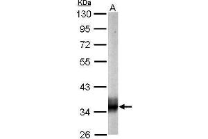 Western Blotting (WB) image for anti-Succinate-CoA Ligase, alpha Subunit (SUCLG1) antibody (ABIN2856658)