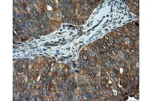 Immunohistochemical staining of paraffin-embedded Kidney tissue using anti-RC201933 mouse monoclonal antibody. (PIM2 抗体)