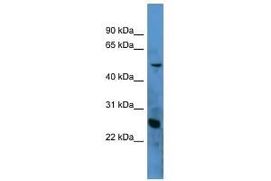 Western Blot showing C1QA antibody used at a concentration of 1-2 ug/ml to detect its target protein. (C1QA 抗体  (N-Term))