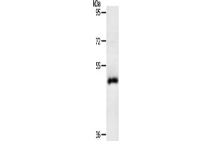 Gel: 10 % SDS-PAGE, Lysate: 40 μg, Lane: Human liver cancer tissue, Primary antibody: ABIN7131158(SPATA17 Antibody) at dilution 1/200, Secondary antibody: Goat anti rabbit IgG at 1/8000 dilution, Exposure time: 10 minutes (SPATA17 抗体)