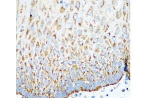 Immunohistochemistry of paraffin-embedded Human esophagus using MTCO2 Polyclonal Antibody at dilution of 1:100 (40x lens). (COX2 抗体)