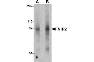 Western blot analysis of FNIP2 in mouse skeletal muscle lysate with AP30346PU-N FNIP2 antibody at (A) 1 and (B) 2 μg/ml. (FNIP2 抗体  (N-Term))