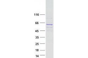 Western Blotting (WB) image for RUN Domain Containing 3B (RUNDC3B) (Transcript Variant 1) protein (Myc-DYKDDDDK Tag) (ABIN2731251)