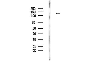 Western blot analysis of lysates from Hela cells(LPS,4h treatment), using Phospho-Nephrin (Tyr1217) Antibody at 1/1000 dilution.