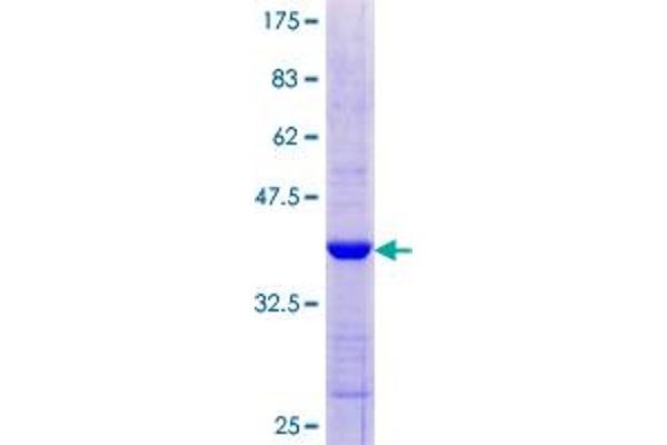 IFIH1 Protein (AA 928-1023) (GST tag)