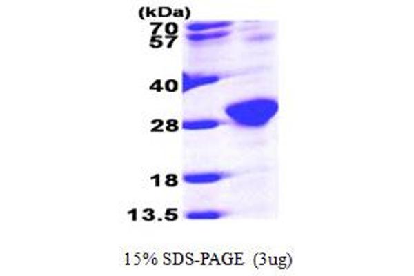 RAB6A Protein (AA 1-208) (His tag)