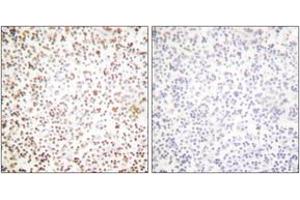 Immunohistochemistry (IHC) image for anti-POU Domain, Class 2, Transcription Factor 1 (POU2F1) (AA 41-90) antibody (ABIN1533361)