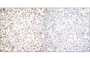 Immunohistochemistry analysis of paraffin-embedded human lymph node tissue, using OCT1 Antibody. (POU2F1 抗体  (AA 41-90))