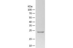 ZWINT Protein (AA 1-230) (His tag)