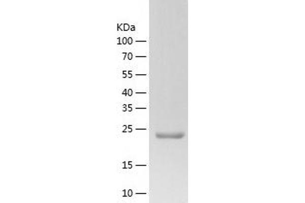 ZWINT Protein (AA 1-230) (His tag)