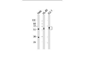 All lanes : Anti-FGL2 Antibody (C-term) at 1:2000 dilution Lane 1: Hela whole cell lysate Lane 2: HL-60 whole cell lysate Lane 3: KG-1 whole cell lysate Lysates/proteins at 20 μg per lane. (FGL2 抗体  (C-Term))
