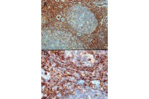 Immunohistochemistry (IHC) image for anti-Ras-Related C3 Botulinum Toxin Substrate 2 (Rho Family, Small GTP Binding Protein Rac2) (RAC2) (C-Term) antibody (ABIN184689)