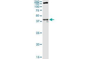 OPRM1 polyclonal antibody (A01). (Mu Opioid Receptor 1 抗体  (AA 1-110))