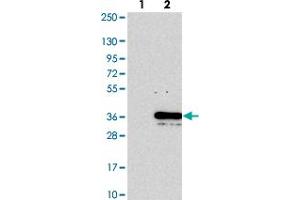 Western blot analysis of Lane 1: Negative control (vector only transfected HEK293T lysate). (PYM 抗体)