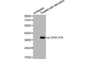 Western blot analysis of extracts from 293 cells using Phospho-CDK6-Y24 antibody. (CDK6 抗体  (pTyr24))