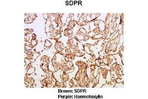 Sample Type :  Human placental tissue   Primary Antibody Dilution :   1:50  Secondary Antibody :  Goat anti rabbit-HRP   Secondary Antibody Dilution :   1:10,000  Color/Signal Descriptions :  Brown: SDPR Purple: Haemotoxylin  Gene Name :  Sdpr  Submitted by :  Dr. (SDPR 抗体  (N-Term))