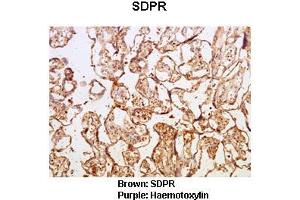 Sample Type :  Human placental tissue   Primary Antibody Dilution :   1:50  Secondary Antibody :  Goat anti rabbit-HRP   Secondary Antibody Dilution :   1:10,000  Color/Signal Descriptions :  Brown: SDPR Purple: Haemotoxylin  Gene Name :  Sdpr  Submitted by :  Dr.