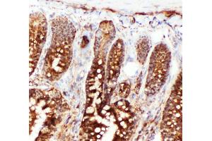 Anti-Hsc70 antibody, IHC(F) IHC(F): Rat Intestine Tissue (Hsc70 抗体  (N-Term))