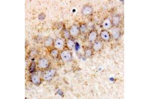 Immunohistochemical analysis of HSPA6 staining in rat brain formalin fixed paraffin embedded tissue section. (HSPA6 抗体)