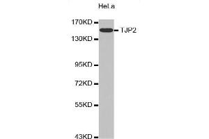 Western Blotting (WB) image for anti-Tight Junction Protein 2 (Zona Occludens 2) (TJP2) (AA 951-1190) antibody (ABIN6213898) (TJP2 抗体  (AA 951-1190))