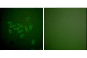 Immunofluorescence analysis of A549 cells, using FHIT antibody (ABIN5976398). (FHIT 抗体  (Internal Region))