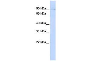 WB Suggested Anti-ZCCHC14 Antibody Titration: 0. (ZCCHC14 抗体  (N-Term))