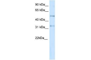 KCNAB2 antibody used at 1 ug/ml to detect target protein. (KCNAB2 抗体  (Middle Region))