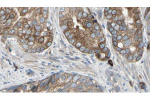 ABIN6274467 at 1/100 staining Human prostate tissue by IHC-P. (PMEPA1 抗体  (Internal Region))