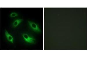 Immunofluorescence analysis of HeLa cells, using EPHB6 Antibody. (EPH Receptor B6 抗体  (AA 861-910))