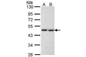 WB Image Sample (30 ug of whole cell lysate) A: H1299 B: Hela 10% SDS PAGE antibody diluted at 1:1000 (KRR1 抗体)