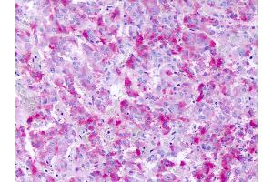 Anti-GPR139 antibody IHC of human adrenal medulla. (GPR139 抗体  (Cytoplasmic Domain))